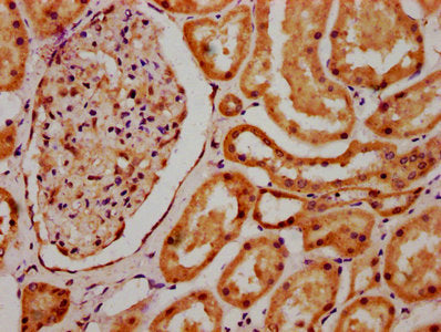 IHC image of CSB-PA020827LA01HU diluted at 1:700 and staining in paraffin-embedded human kidney tissue performed on a Leica BondTM system. After dewaxing and hydration, antigen retrieval was mediated by high pressure in a citrate buffer (pH 6.0)....
