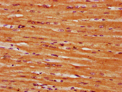 IHC image of CSB-PA020835LA01HU diluted at 1:300 and staining in paraffin-embedded human heart tissue performed on a Leica BondTM system. After dewaxing and hydration, antigen retrieval was mediated by high pressure in a citrate buffer (pH 6.0). S...