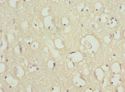 Immunohistochemistry of paraffin-embedded human brain tissue using CSB-PA020838ESR1HU at dilution of 1:100