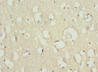 Immunohistochemistry of paraffin-embedded human brain tissue using CSB-PA020838ESR1HU at dilution of 1:100