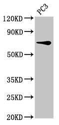 Western Blot Positive WB detected in: PC-3 whole cell lysate All lanes: SCNN1B antibody at 8µg/ml Secondary Goat polyclonal to rabbit IgG at 1/50000 dilution Predicted band size: 73, 78 kDa Observed band size: 73 kDa