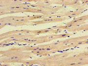 Immunohistochemistry of paraffin-embedded human heart tissue using CSB-PA020852LA01HU at dilution of 1:100