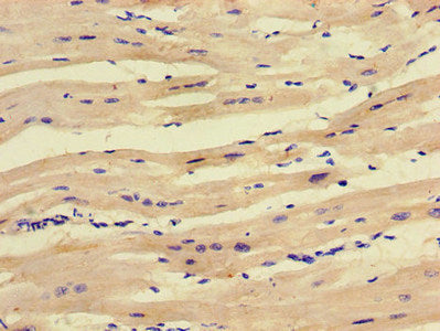 Immunohistochemistry of paraffin-embedded human heart tissue using CSB-PA020852LA01HU at dilution of 1:100