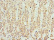Immunohistochemistry of paraffin-embedded human adrenal gland tissue using CSB-PA020853ESR2HU at dilution of 1:100