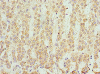 Immunohistochemistry of paraffin-embedded human adrenal gland tissue using CSB-PA020853ESR2HU at dilution of 1:100