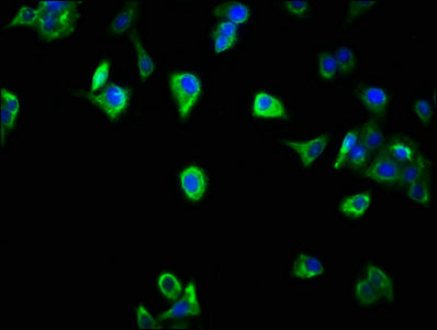 Immunofluorescence staining of HepG2 cells with CSB-PA020854LA01HU at 1:266, counter-stained with DAPI. The cells were fixed in 4% formaldehyde, permeabilized using 0.2% Triton X-100 and blocked in 10% normal Goat Serum. The cells were then incuba...