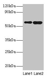 Western blot All lanes: SCP2 antibody at 2µg/ml Lane 1: A549 whole cell lysate Lane 2: MCF-7 whole cell lysate Secondary Goat polyclonal to rabbit IgG at 1/10000 dilution Predicted band size: 59, 16, 35, 51, 7, 55, 57 kDa Observed band size: 59 kDa
