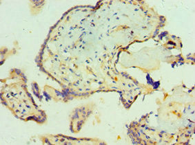 Immunohistochemistry of paraffin-embedded human placenta tissue using CSB-PA020856ESR1HU at dilution of 1:100