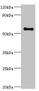 Western blot All lanes: SCP2 antibody at 6µg/ml + A2780 whole cell lysate Secondary Goat polyclonal to rabbit IgG at 1/10000 dilution Predicted band size: 59, 16, 35, 51, 7, 55, 57 kDa Observed band size: 59 kDa