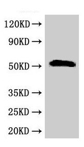 Western Blot Positive WB detected in: Rat liver tissue All lanes: SCTR antibody at 2.5µg/ml Secondary Goat polyclonal to rabbit IgG at 1/50000 dilution Predicted band size: 51 kDa Observed band size: 51 kDa