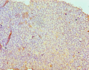 Immunohistochemistry of paraffin-embedded human tonsil tissue using CSB-PA020888ESR2HU at dilution of 1:100
