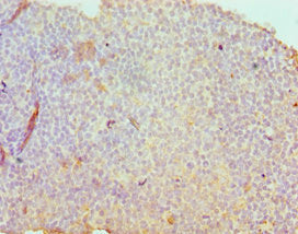 Immunohistochemistry of paraffin-embedded human tonsil tissue using CSB-PA020888ESR2HU at dilution of 1:100