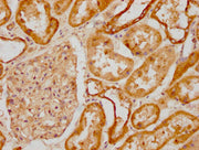 IHC image of CSB-PA020888HA01HU diluted at 1:1200 and staining in paraffin-embedded human kidney tissue performed on a Leica BondTM system. After dewaxing and hydration, antigen retrieval was mediated by high pressure in a citrate buffer (pH 6.0)....