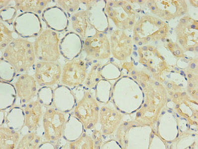 Immunohistochemistry of paraffin-embedded human kidney tissue using CSB-PA020900LA01HU at dilution of 1:100