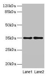 Western blot All lanes: SDSL antibody at 4µg/ml Lane 1: HepG2 whole cell lysate Lane 2: Mouse liver tissue Secondary Goat polyclonal to rabbit IgG at 1/10000 dilution Predicted band size: 35 kDa Observed band size: 35 kDa