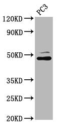 Western Blot Positive WB detected in: PC-3 whole cell lysate All lanes: SEC14L2 antibody at 4.28µg/ml Secondary Goat polyclonal to rabbit IgG at 1/50000 dilution Predicted band size: 47, 45, 37 kDa Observed band size: 47 kDa