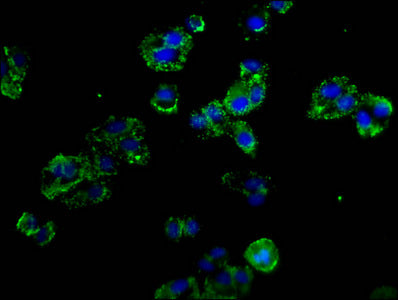 Immunofluorescence staining of HepG2 cells with CSB-PA020978LA01HU at 1:100, counter-stained with DAPI. The cells were fixed in 4% formaldehyde, permeabilized using 0.2% Triton X-100 and blocked in 10% normal Goat Serum. The cells were then incuba...