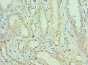 Immunohistochemistry of paraffin-embedded human kidney tissue using CSB-PA021001ESR2HU at dilution of 1:100
