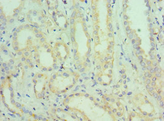 Immunohistochemistry of paraffin-embedded human kidney tissue using CSB-PA021001ESR2HU at dilution of 1:100