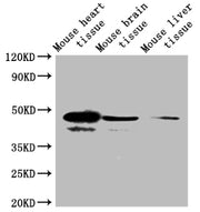 Western Blot Positive WB detected in: Mouse brain tissue, Mouse skeletal muscle tissue All lanes: SEPP1 antibody at 4ug/ml Secondary Goat polyclonal to rabbit IgG at 1/50000 dilution Predicted band size: 43 kDa Observed band size: 43, 40 kDa