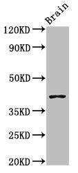 Western Blot Positive WB detected in: Mouse brain tissue All lanes: SEPT3 antibody at 3ug/ml Secondary Goat polyclonal to rabbit IgG at 1/50000 dilution Predicted band size: 41, 10 kDa Observed band size: 41 kDa