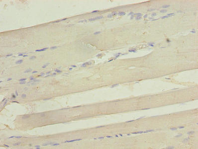 Immunohistochemistry of paraffin-embedded human skeletal muscle tissue using CSB-PA021034LA01HU at dilution of 1:100