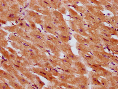 IHC image of CSB-PA021040LA01HU diluted at 1:300 and staining in paraffin-embedded human heart tissue performed on a Leica BondTM system. After dewaxing and hydration, antigen retrieval was mediated by high pressure in a citrate buffer (pH 6.0). S...