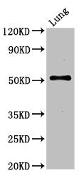 Western Blot Positive WB detected in: Mouse lung tissue All lanes: SERINC1 antibody at 3ug/ml Secondary Goat polyclonal to rabbit IgG at 1/50000 dilution Predicted band size: 51 kDa Observed band size: 51 kDa