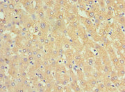 Immunohistochemistry of paraffin-embedded human liver tissue using CSB-PA021059ESR1HU at dilution of 1:100