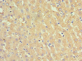 Immunohistochemistry of paraffin-embedded human liver tissue using CSB-PA021059ESR1HU at dilution of 1:100