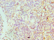 Immunohistochemistry of paraffin-embedded human pancreatic tissue using CSB-PA021060ESR2HU at dilution of 1:100