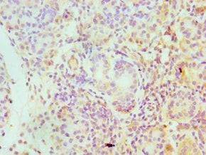 Immunohistochemistry of paraffin-embedded human pancreatic tissue using CSB-PA021060ESR2HU at dilution of 1:100