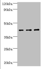 Western blot All lanes: Leukocyte elastase inhibitor antibody at 4ug/ml Lane 1: MCF-7 whole cell lysate Lane 2: Hela whole cell lysate Lane 3: HepG2 whole cell lysate Secondary Goat polyclonal to rabbit IgG at 1/10000 dilution Predicted band size:...