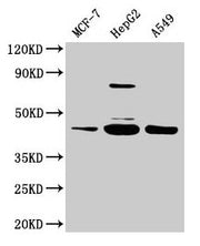 Western Blot Positive WB detected in: MCF-7 whole cell lysate, HepG2 whole cell lysate, A549 whole cell lysate All lanes: SERPINB1 antibody at 2µg/ml Secondary Goat polyclonal to rabbit IgG at 1/50000 dilution Predicted band size: 43, 27 kDa Obser...