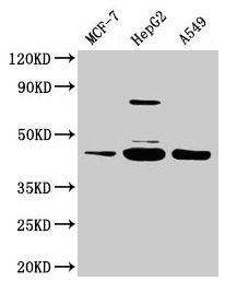 Western Blot Positive WB detected in: MCF-7 whole cell lysate, HepG2 whole cell lysate, A549 whole cell lysate All lanes: SERPINB1 antibody at 2µg/ml Secondary Goat polyclonal to rabbit IgG at 1/50000 dilution Predicted band size: 43, 27 kDa Obser...