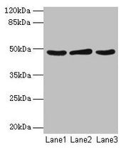Western blot All lanes: Serpinb2 antibody at 2µg/ml Lane 1: MCF-7 whole cell lysate Lane 2: 293T whole cell lysate Lane 3: Rat liver tissue Secondary Goat polyclonal to rabbit IgG at 1/10000 dilution Predicted band size: 48 kDa Observed band size:...