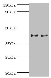 Western blot All lanes: Serpin B5 antibody at 2ug/ml Lane 1: HepG2 whole cell lysate Lane 2: A431 whole cell lysate Secondary Goat polyclonal to rabbit IgG at 1/10000 dilution Predicted band size: 43, 26 kDa Observed band size: 43 kDa