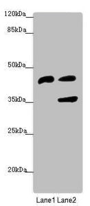 Western blot All lanes: SERPINB6 antibody at 0.95 ug/ml Lane 1: Human placenta tissue Lane 2: HepG2 whole cell lysate Secondary Goat polyclonal to rabbit IgG at 1/10000 dilution Predicted band size: 43 kDa Observed band size: 43, 36 kDa