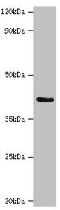 Western blot All lanes: Serpin B9 antibody at 3ug/ml + K562 whole cell lysate Secondary Goat polyclonal to rabbit IgG at 1/10000 dilution Predicted band size: 42 kDa Observed band size: 42 kDa