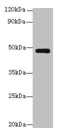 Western blot All lanes: Serpinh1 antibody at 6µg/ml + Jurkat whole cell lysate Secondary Goat polyclonal to rabbit IgG at 1/10000 dilution Predicted band size: 47 kDa Observed band size: 47 kDa