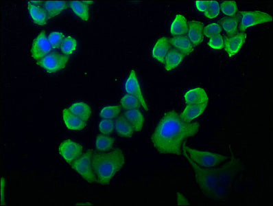 Immunofluorescence staining of Hela cells with CSB-PA021096NA01HU at 1:100, counter-stained with DAPI. The cells were fixed in 4% formaldehyde, permeabilized using 0.2% Triton X-100 and blocked in 10% normal Goat Serum. The cells were then incubat...
