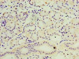 Immunohistochemistry of paraffin-embedded human pancreatic tissue using CSB-PA021097ESR2HU at dilution of 1:100