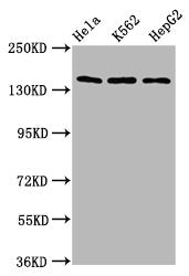 Western Blot Positive WB detected in: Hela whole cell lysate, K562 whole cell lysate, HepG2 whole cell lysate All lanes: SF3B1 antibody at 9.8µg/ml Secondary Goat polyclonal to rabbit IgG at 1/50000 dilution Predicted band size: 146, 17 kDa Observ...
