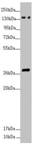 Western blot All lanes: SFI1 antibody at 4.26 ug/ml + HepG2 whole cell lysate Secondary Goat polyclonal to rabbit IgG at 1/10000 dilution Predicted band size: 148, 144, 139, 122, 118, 142, 137 kDa Observed band size: 148, 38 kDa