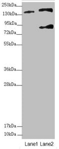 Western blot All lanes: SFI1 antibody at 2.9 ug/ml Lane 1: A549 whole cell lysate Lane 2: HepG2 whole cell lysate Secondary Goat polyclonal to rabbit IgG at 1/10000 dilution Predicted band size: 148, 144, 139, 122, 118, 142, 137 kDa Observed band...