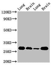 Western Blot Positive WB detected in: Rat lung tissue, Rat brain tissue, Mouse lung tissue, Mouse brain tissue All lanes: SFN antibody at 5ug/ml Secondary Goat polyclonal to rabbit IgG at 1/50000 dilution Predicted band size: 28, 25 kDa Observed b...
