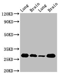 Western Blot Positive WB detected in: Rat lung tissue, Rat brain tissue, Mouse lung tissue, Mouse brain tissue All lanes: SFN antibody at 5ug/ml Secondary Goat polyclonal to rabbit IgG at 1/50000 dilution Predicted band size: 28, 25 kDa Observed b...