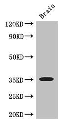 Western Blot Positive WB detected in: Mouse brain tissue All lanes: SFRP1 antibody at 3ug/ml Secondary Goat polyclonal to rabbit IgG at 1/50000 dilution Predicted band size: 36 kDa Observed band size: 36 kDa