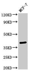 Western Blot Positive WB detected in: MCF-7 whole cell lysate All lanes: SFRP4 antibody at 3ug/ml Secondary Goat polyclonal to rabbit IgG at 1/50000 dilution Predicted band size: 40 kDa Observed band size: 40 kDa
