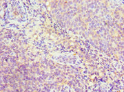 Immunohistochemistry of paraffin-embedded human tonsil tissue using CSB-PA021156ESR1HU at dilution of 1:100
